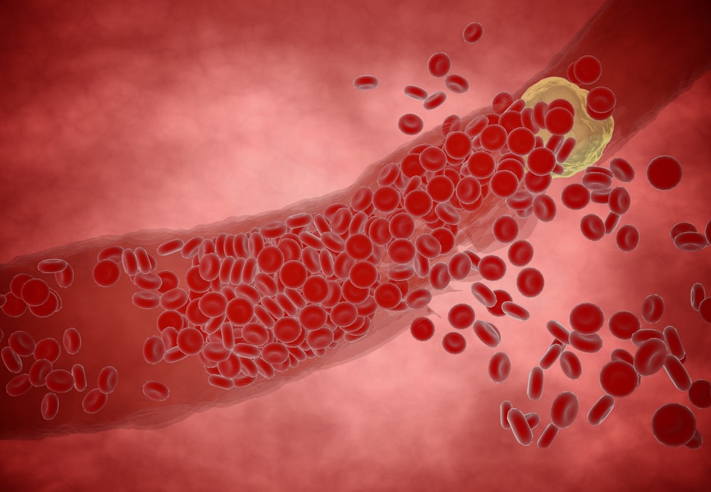 Colesterol bom e ruim: entenda a diferença entre eles – LabVital